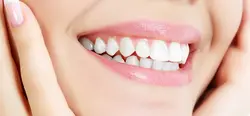 Smile Designing 