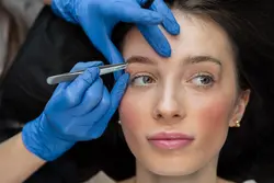 Eyebrow Transplant