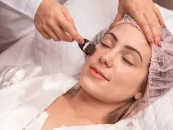 Derma Roller Treatment