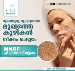 Cosmetic Dermatology