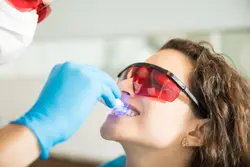  Tooth Whitening 