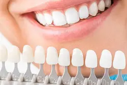 Dental Cosmetic Treatments