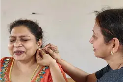 Auricular therapy