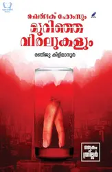 Sherlock Holmesum Murinja Viralukalum - ഷെര്‍ലക് ഹോംസും മുറിഞ്ഞ വിരലുകളും