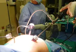 Department of general, minimal access and bariatric surgery