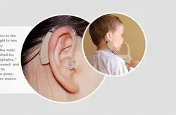 Cochlear Implantation Program