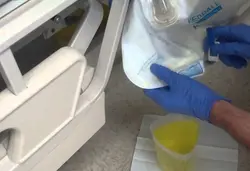 Remove urine and stool