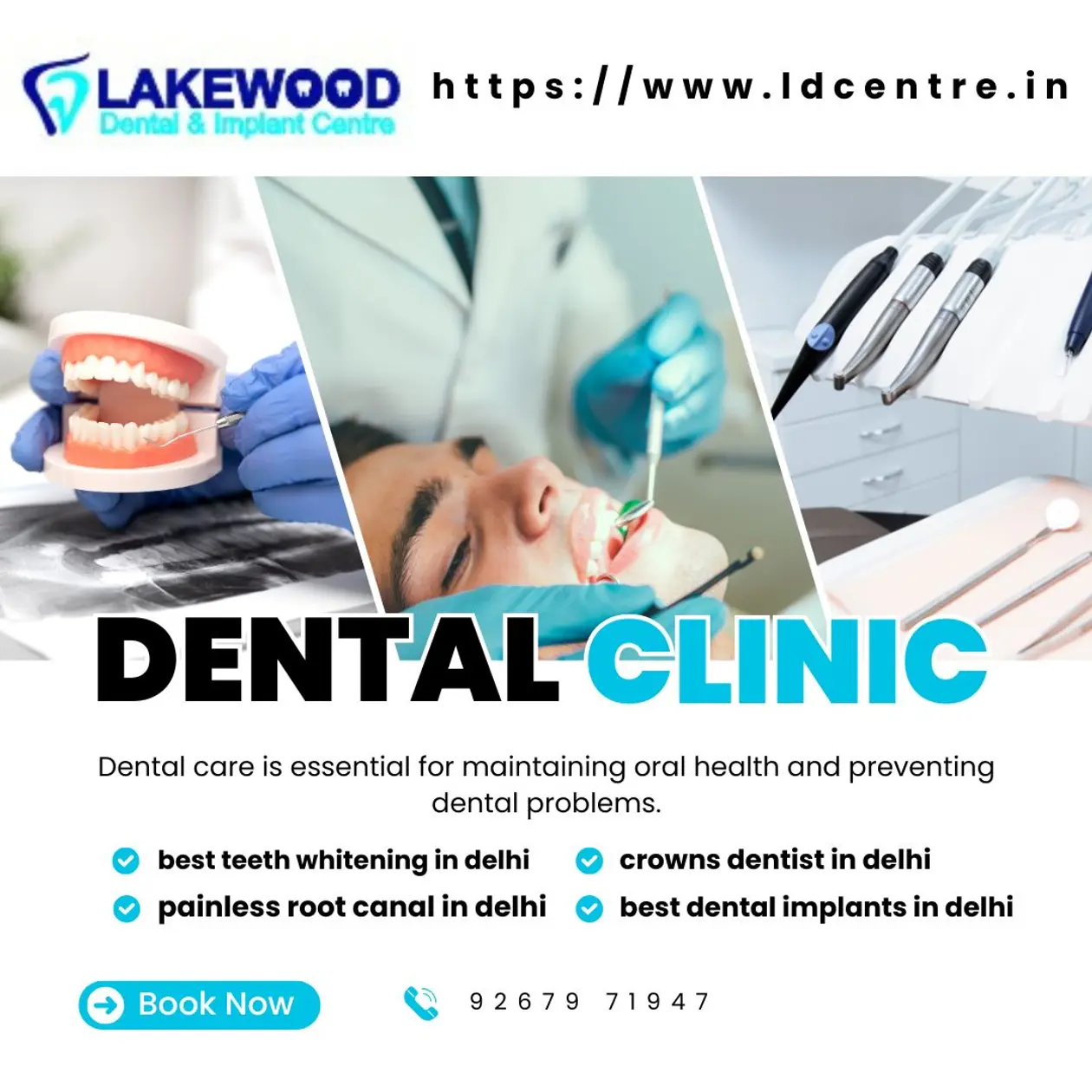 Lakewood Dental & Implant Centre 