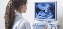 Ultrasound Monitoring 