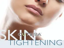 Laser Skin Tightening