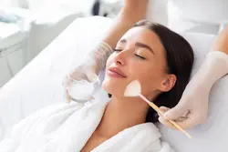 Chemical Peels