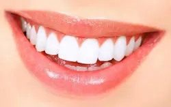 Teeth whitening 