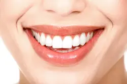 Professional Teeth Cleaning