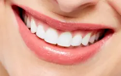 Teeth Whitening
