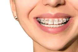 Orthodontics Treatments