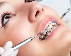 Orthodontics Treatments